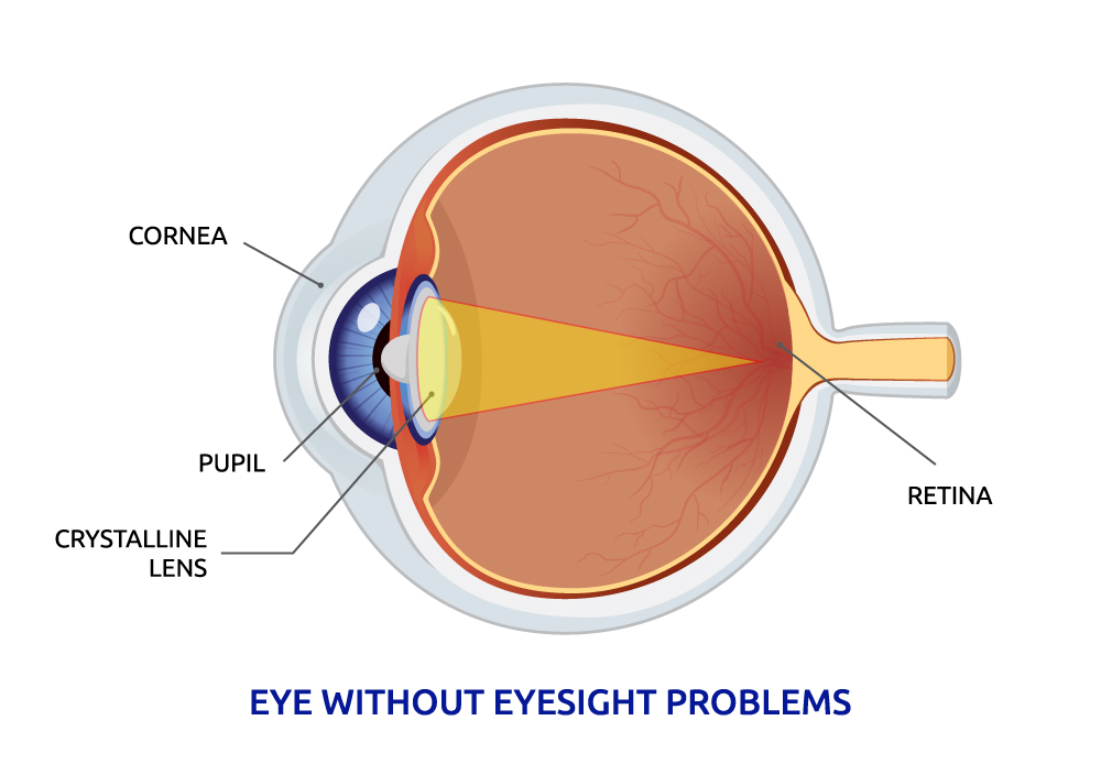 Eye without eyesight problems